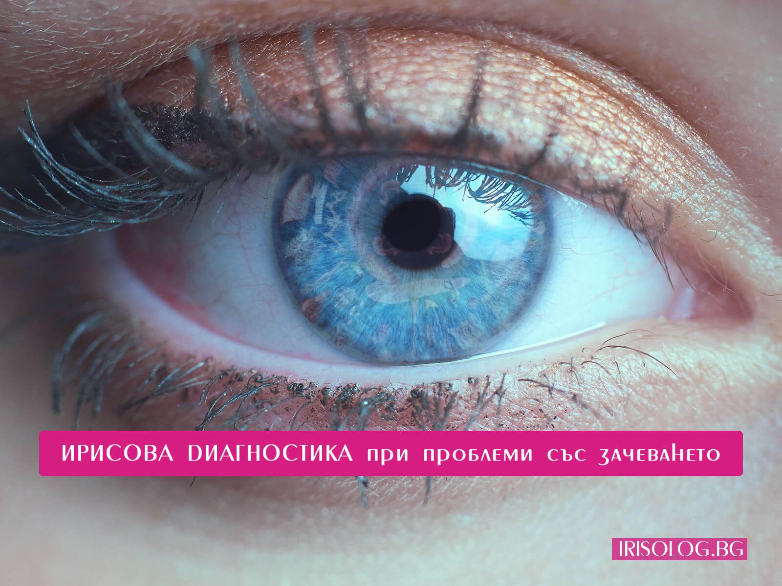 Ирисова Диагностика при проблеми със зачеването