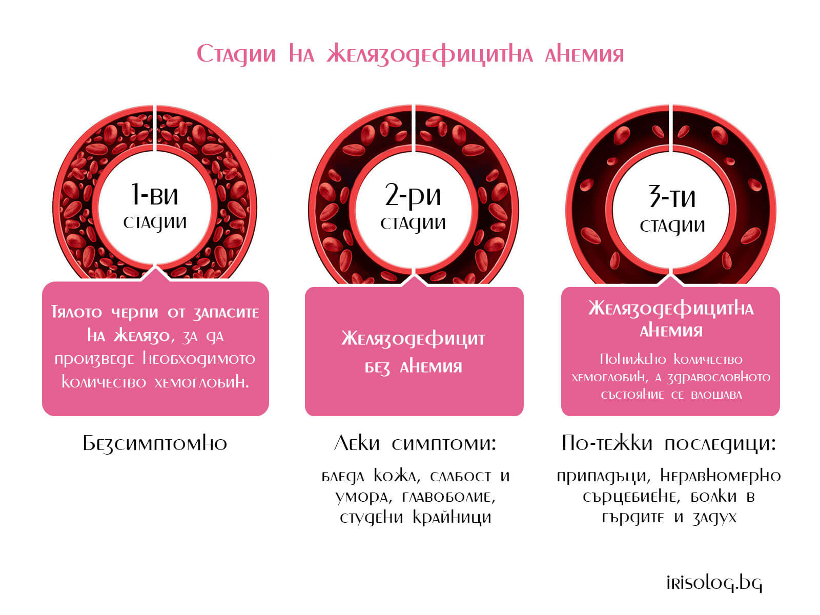 Стадии на желязодефицитна анемия
