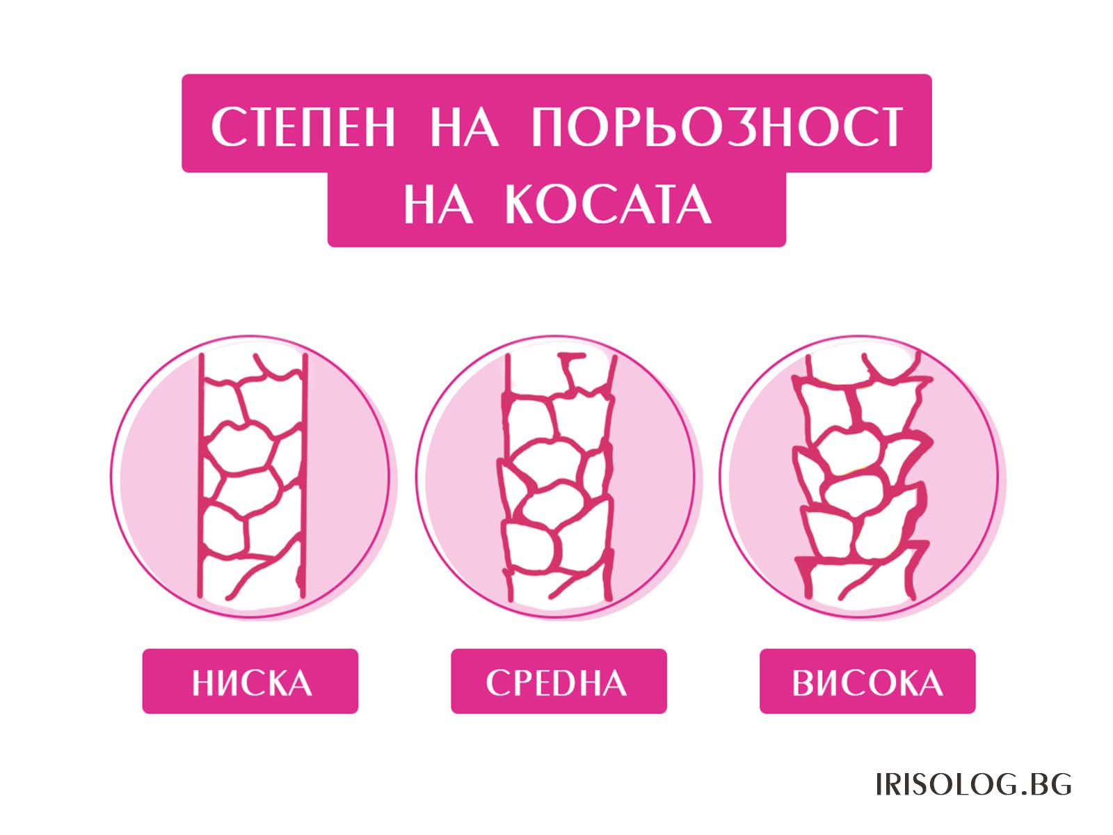 Степени на порьозност на косата