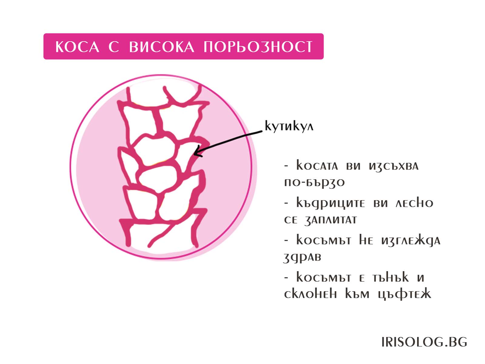 Висока порьозност на косата