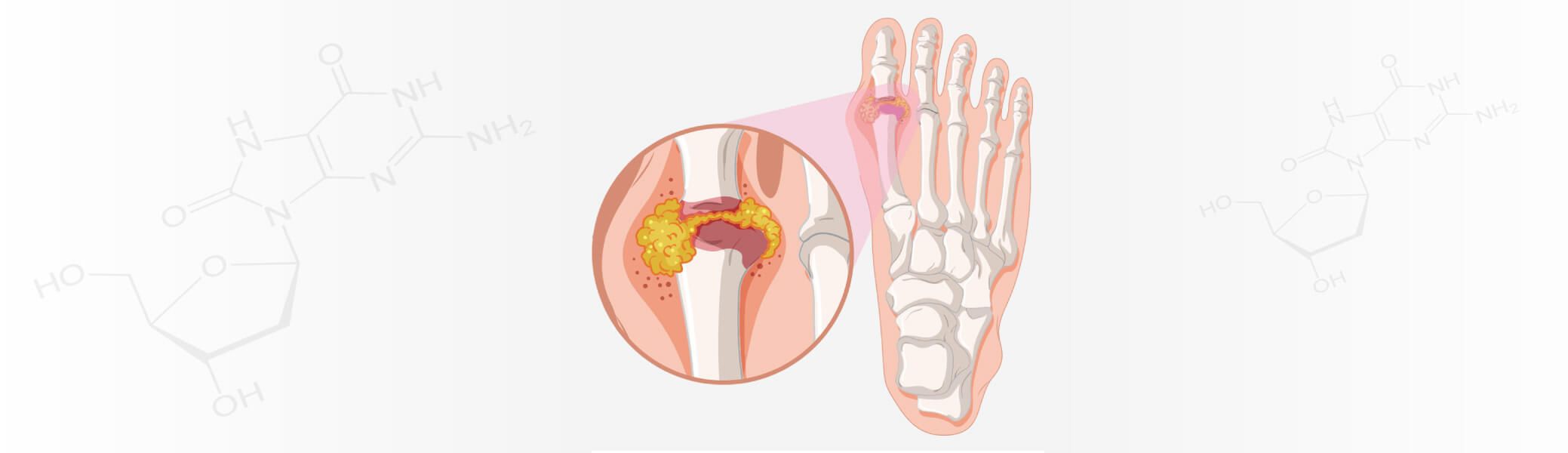 ЦАРСКАТА БОЛЕСТ